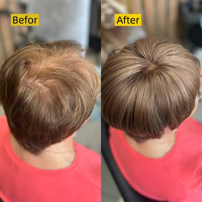 Hot Sale Short Hair Topper for Thinning Hair – Natural Look, Easy Clip-In
